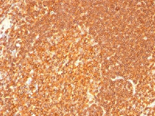 HLA-DRB1 Antibody