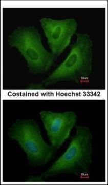PSMA6 Rabbit Polyclonal Antibody