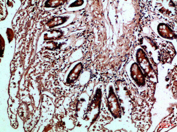 HLA-DMB Antibody