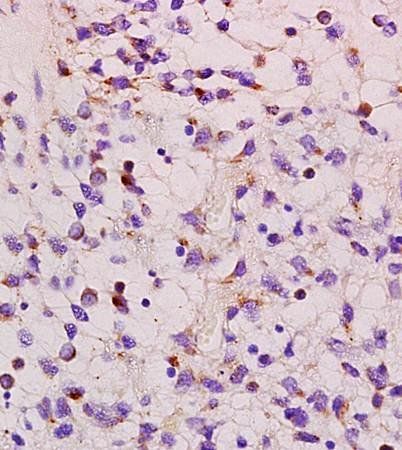 HMGA1 Rabbit Polyclonal Antibody