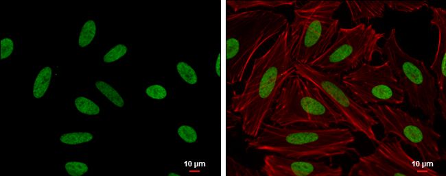 HMGA2 Rabbit Polyclonal Antibody