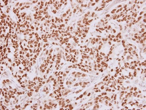 HMGA2 Rabbit Polyclonal Antibody