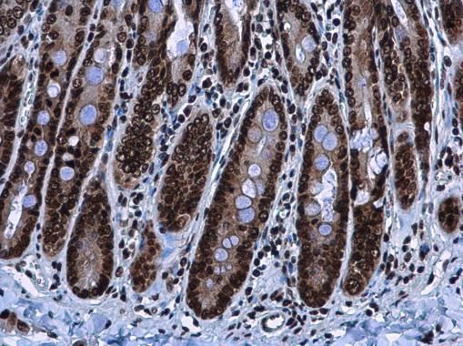 HMGA2 Rabbit Polyclonal Antibody