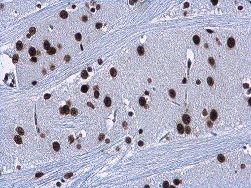 HMGA2 Rabbit Polyclonal Antibody