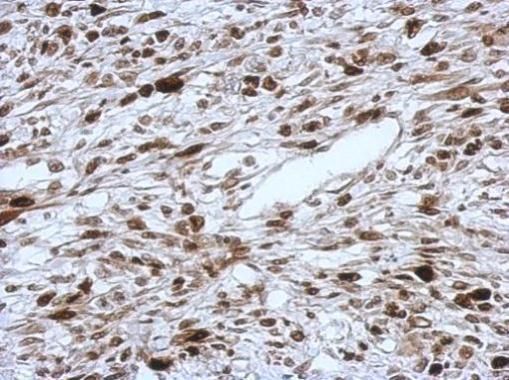 HMGA2 Rabbit Polyclonal Antibody