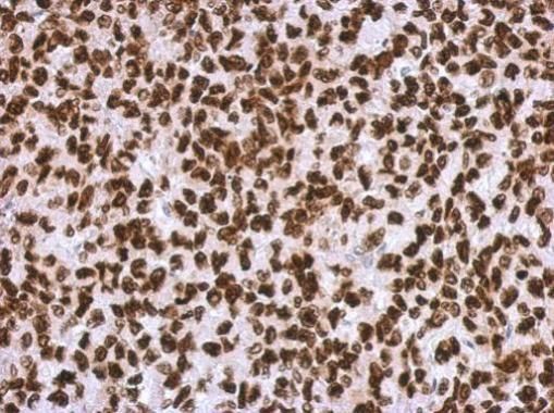 HMGA2 Rabbit Polyclonal Antibody