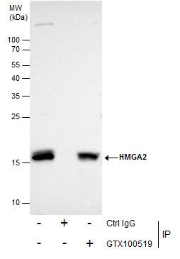 HMGA2 Rabbit Polyclonal Antibody