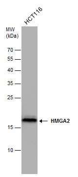 HMGA2 Rabbit Polyclonal Antibody