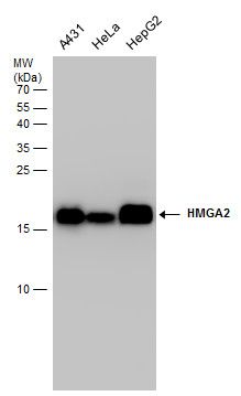 HMGA2 Rabbit Polyclonal Antibody
