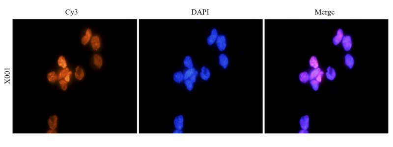 HMGB1 Rabbit Polyclonal Antibody