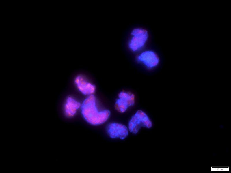 HMGB1 Rabbit Polyclonal Antibody