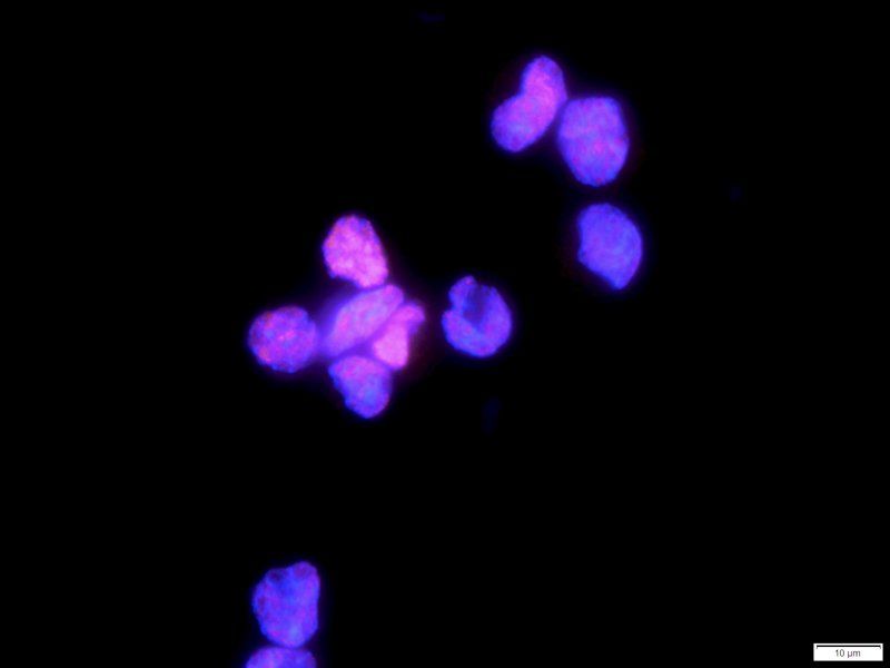 HMGB1 Rabbit Polyclonal Antibody