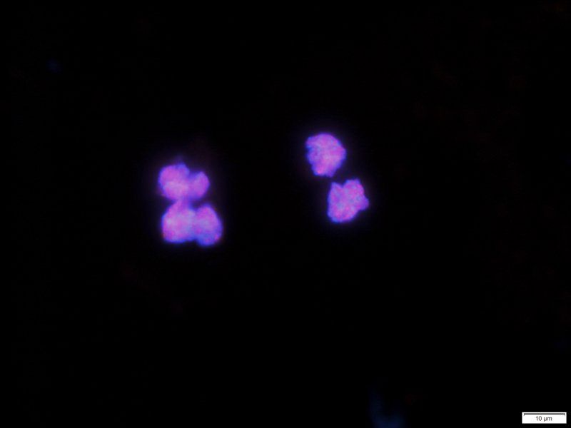 HMGB1 Rabbit Polyclonal Antibody