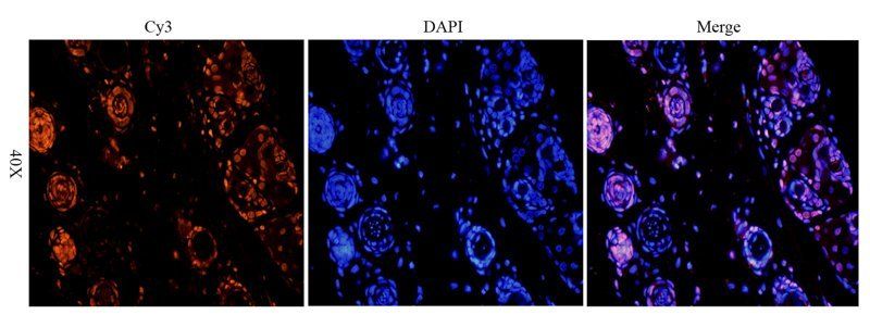 HMGB1 Rabbit Polyclonal Antibody