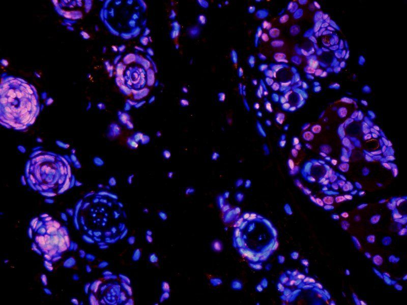 HMGB1 Rabbit Polyclonal Antibody