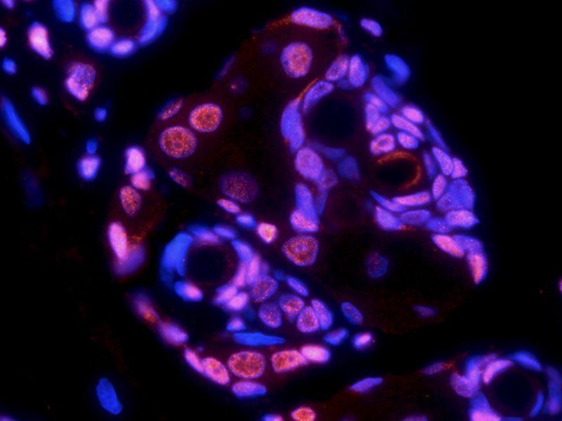 HMGB1 Rabbit Polyclonal Antibody