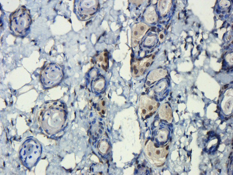 HMGB1 Rabbit Polyclonal Antibody