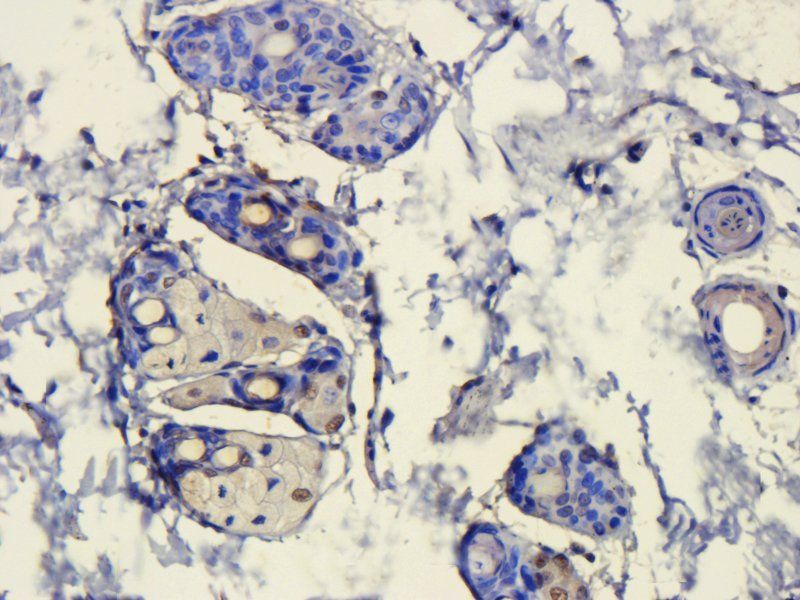 HMGB1 Rabbit Polyclonal Antibody
