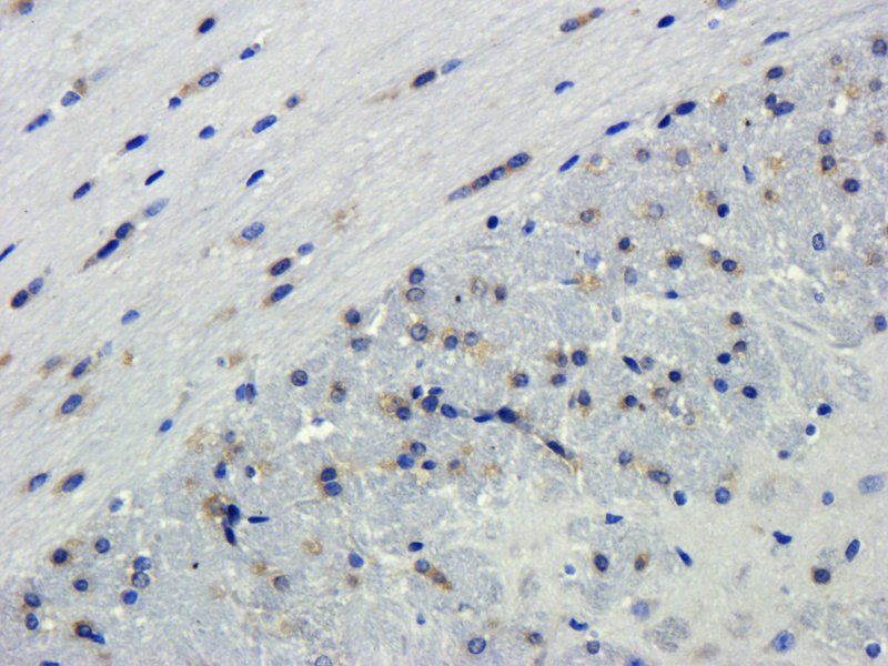HMGB1 Rabbit Polyclonal Antibody