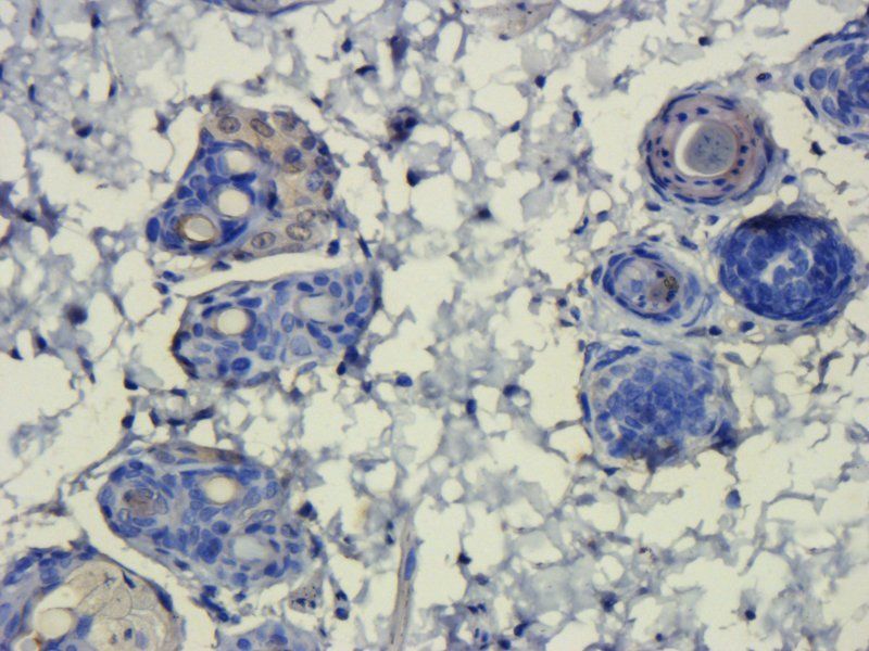 HMGB1 Rabbit Polyclonal Antibody