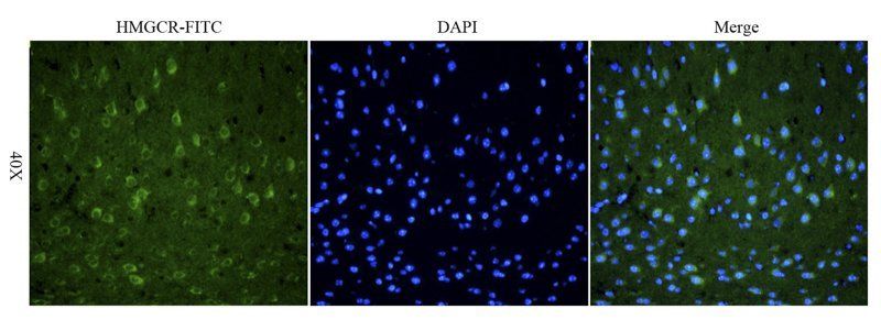 HMGCR Rabbit Polyclonal Antibody (FITC)