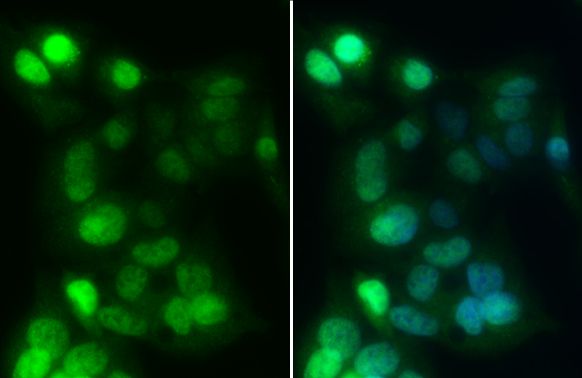HNF1 alpha Rabbit Polyclonal Antibody