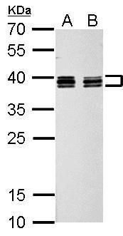 hnRNP C1/C2 Rabbit Polyclonal Antibody