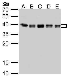 hnRNP C1/C2 Rabbit Polyclonal Antibody