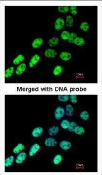 hnRNP F Rabbit Polyclonal Antibody