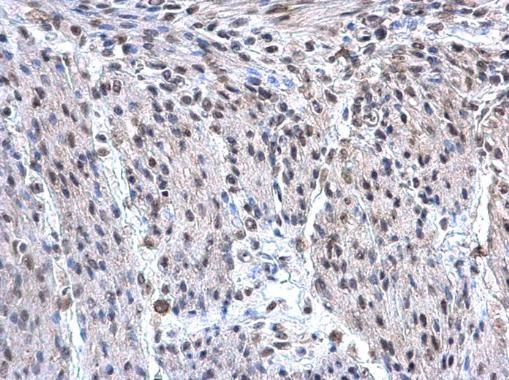 hnRNP F Rabbit Polyclonal Antibody