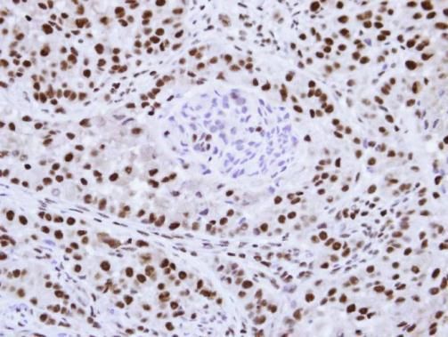 hnRNP F Rabbit Polyclonal Antibody