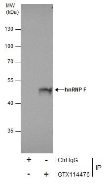 hnRNP F Rabbit Polyclonal Antibody