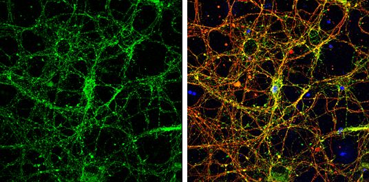 Homer1 Rabbit Polyclonal Antibody