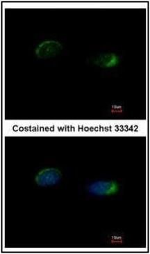 Homer1 Rabbit Polyclonal Antibody
