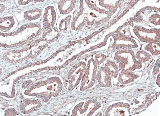 Homer1 Rabbit Polyclonal Antibody