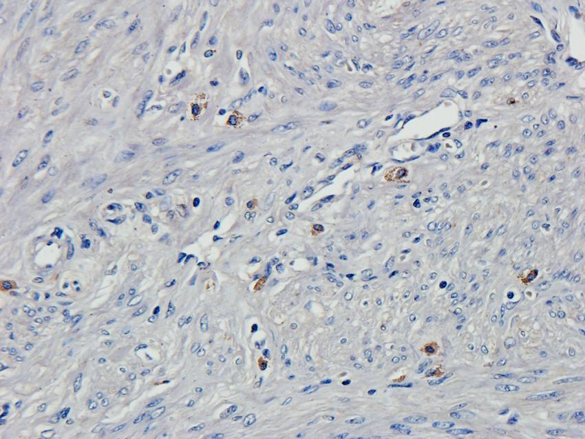 HOXA10 Rabbit Polyclonal Antibody