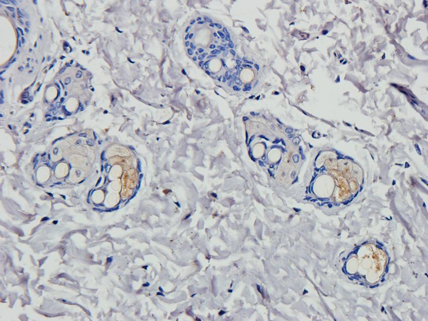 HOXA10 Rabbit Polyclonal Antibody