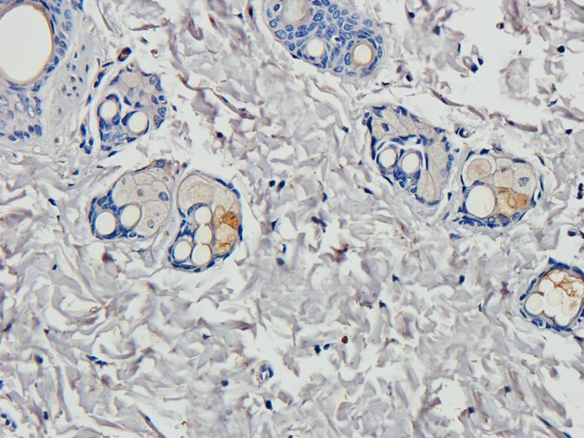 HOXA10 Rabbit Polyclonal Antibody