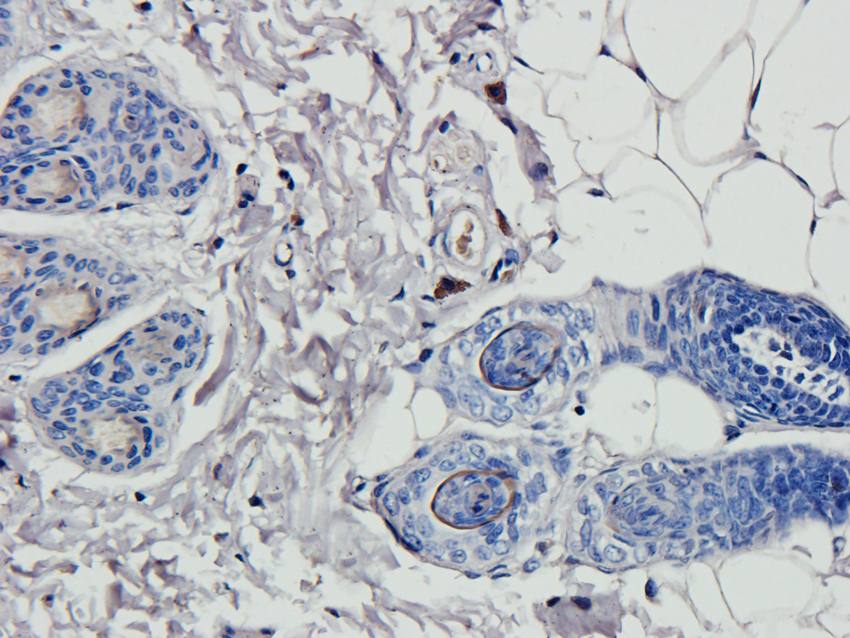 HOXA10 Rabbit Polyclonal Antibody