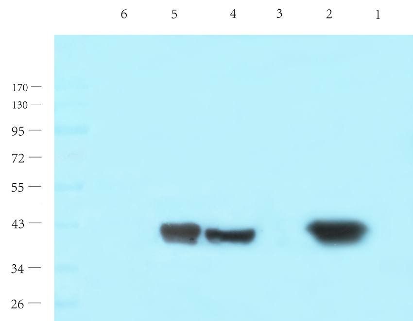 HOXA10 Rabbit Polyclonal Antibody