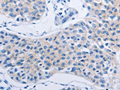 HOXA6 Antibody