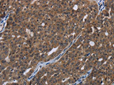 HOXC8 Antibody