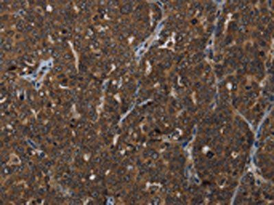 HOXC8 Antibody