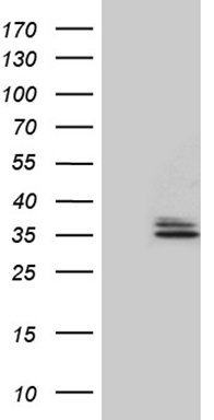 HOXD8 Antibody