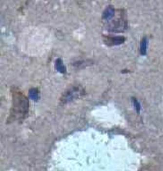 HPCAL4 Rabbit Polyclonal Antibody
