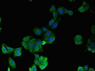 HPGD Antibody