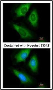 HPRT Rabbit Polyclonal Antibody