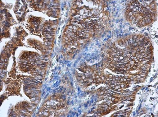 HPRT Rabbit Polyclonal Antibody