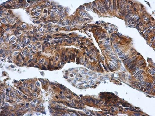 HPRT Rabbit Polyclonal Antibody
