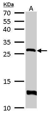 HPRT Rabbit Polyclonal Antibody